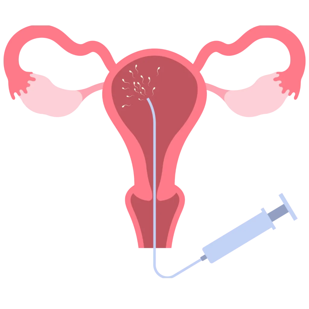 Intrauterine Insemination(IUI)