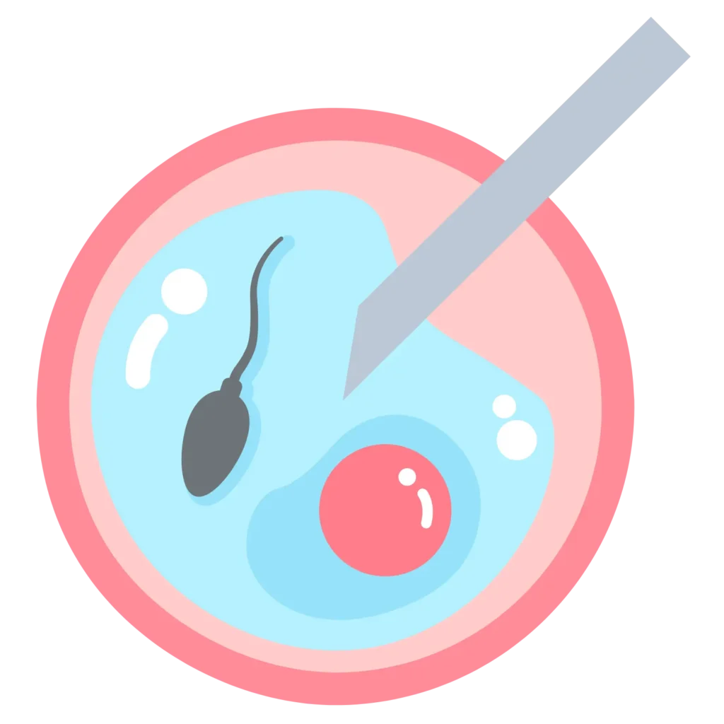 intracytoplasmic sperm injection (ICSI)